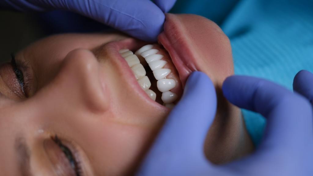 Woman getting veneers